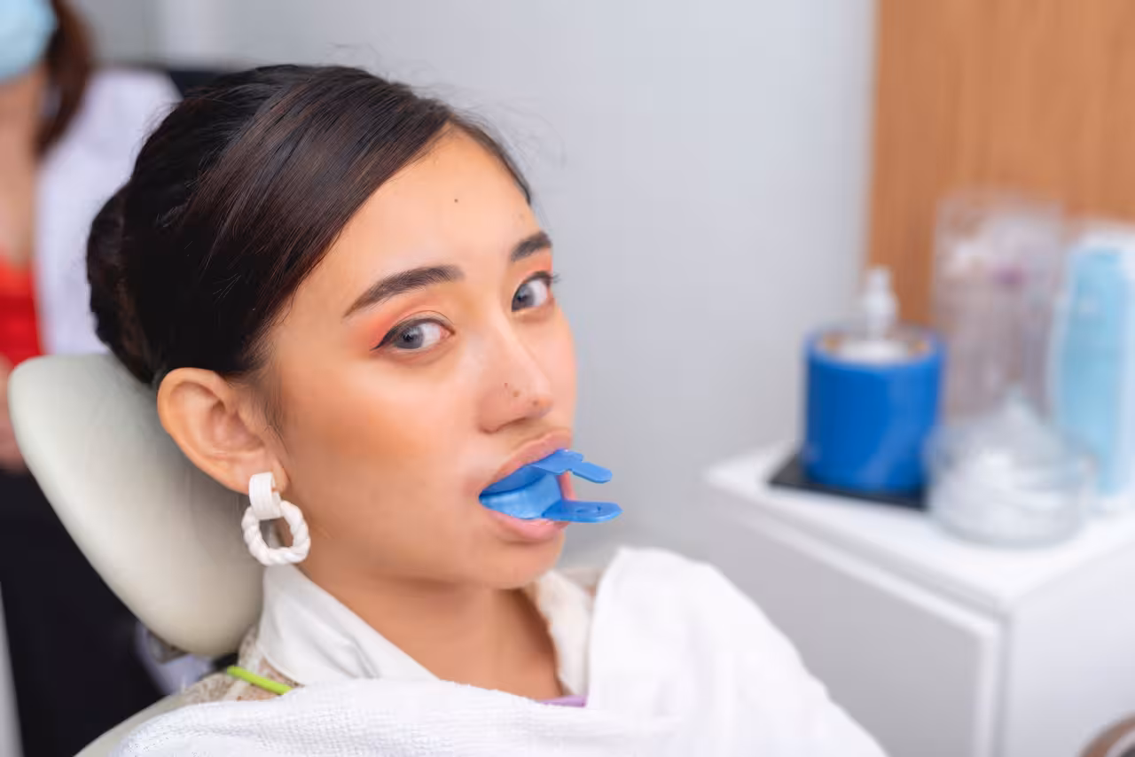 Fluoride Treatment